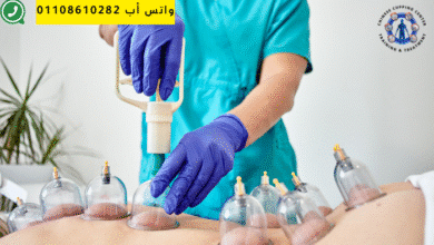 الحجامة علاجًا شاملاً يمكن أن يُقدم فوائد كبيرة لمجموعة متنوعة من الحالات الصحية