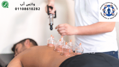 جلسة حجامة وإبر صينية منزلية مريحة | المركز الصيني للعلاج التكميلي