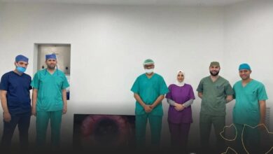 نجاح جراحة دقيقة تعيد الإبصار لمريضة بمجمع السويس الطبي
